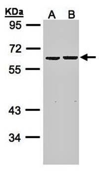 ZNF306 antibody