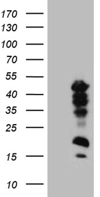 ZNF329 antibody