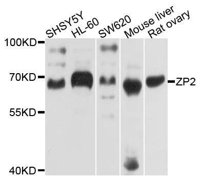 ZP2 antibody