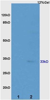 ATP1B2 antibody