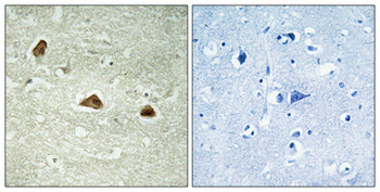 Cytokeratin 18 (phospho Ser52) Polyclonal Antibody
