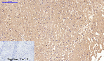 Cystatin C mouse Monoclonal Antibody(7F11)