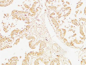 Cystatin C mouse Monoclonal Antibody(7F11)