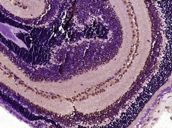 POU4F3 Polyclonal Antibody