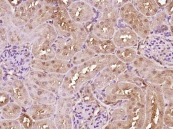 PKNOX1 Polyclonal Antibody