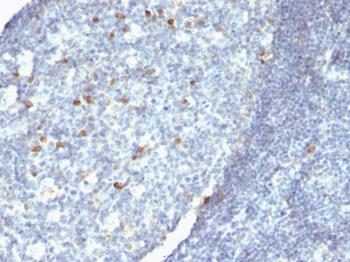 IgM (Immunoglobulin Mu Heavy Chain) (B-Cell Marker) Antibody - With BSA and Azide