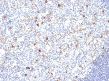 IgM (Immunoglobulin Mu Heavy Chain) (B-Cell Marker) Antibody - With BSA and Azide