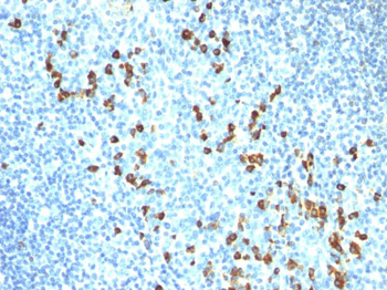 IgM (Immunoglobulin Mu Heavy Chain) (B-Cell Marker) Antibody - With BSA and Azide
