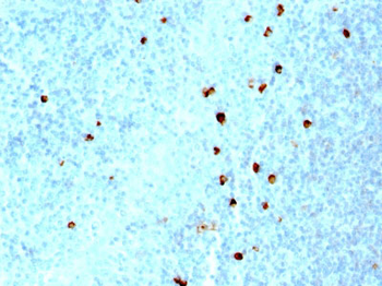 IgM (Immunoglobulin Mu Heavy Chain) (B-Cell Marker) Antibody - With BSA and Azide