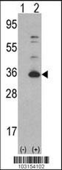 CDK4 Antibody (C-term)