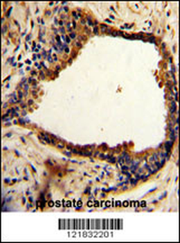 NDRG1 Antibody (N-term)