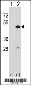 RBM22 Antibody (Center)