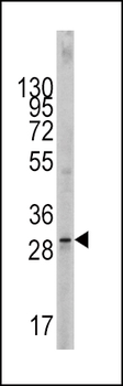 SCF (KITLG) Antibody (C-term)