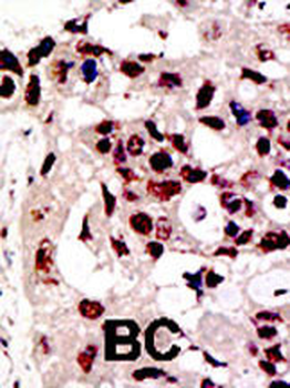 PIAS3 Antibody (C-term)
