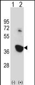 Mouse Nek6 Antibody (C-term)