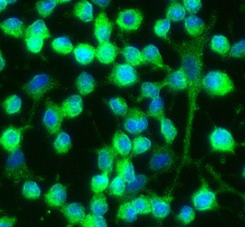 6*His, His-Tag antibody