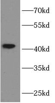 6*His, His-Tag antibody