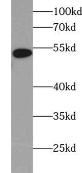 6*His, His-Tag antibody