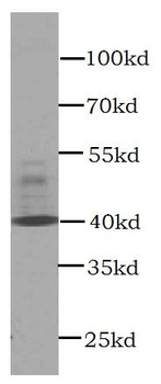 CXCR3B-specific antibody