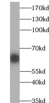 GFP tag antibody