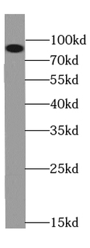 QARS1 Antibody