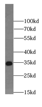 HuR antibody