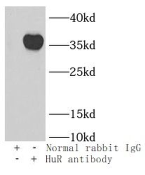 HuR antibody