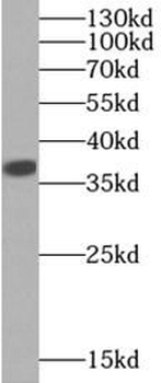 LDHA Antibody