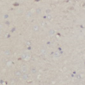 NF200 antibody