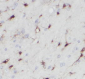 NGEF antibody