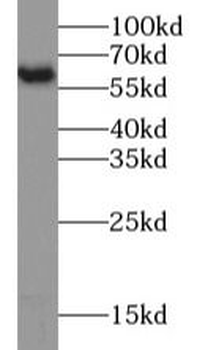 PKM2-specific antibody