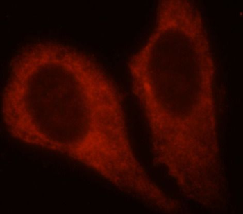 PKM2-specific antibody