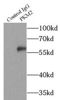 PKM2-specific antibody