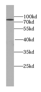 SR-BI antibody