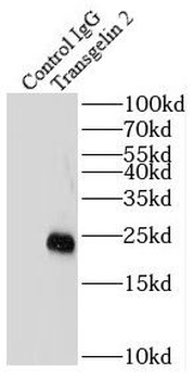 Transgelin 2 antibody