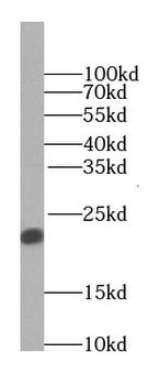 Transgelin-2-specific antibody