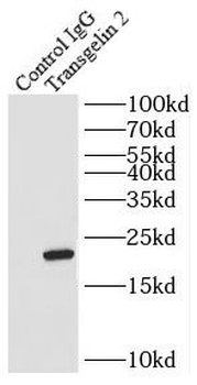 Transgelin-2-specific antibody