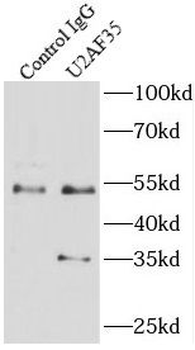 U2AF35 antibody