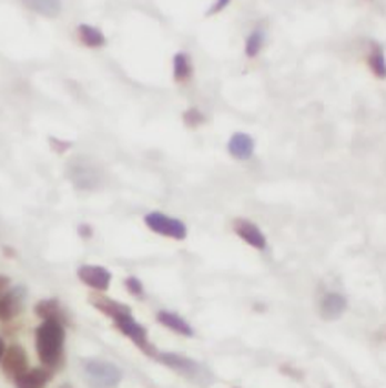 U2AF35 antibody