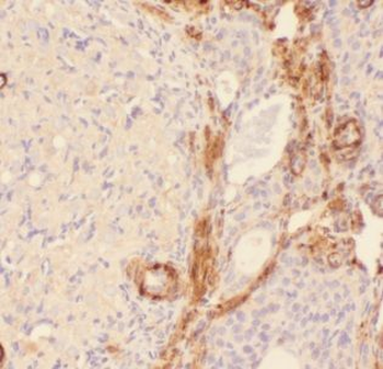 AIG1 antibody