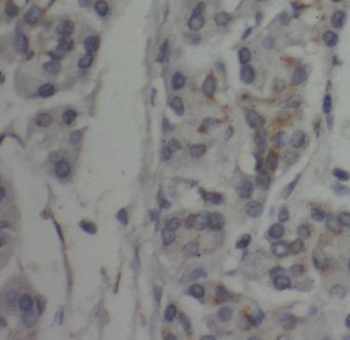 CTDSP2 antibody