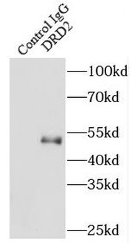 DRD2 Antibody