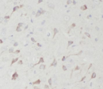 ENO1 Antibody