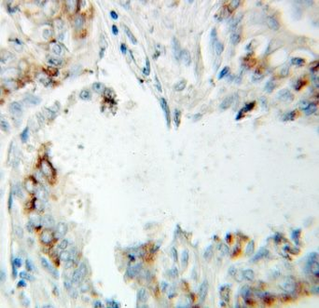 ERAB antibody