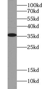 LDHA Antibody