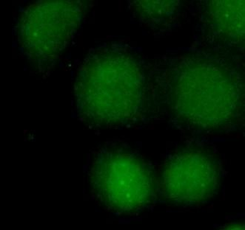 NCOR2 antibody