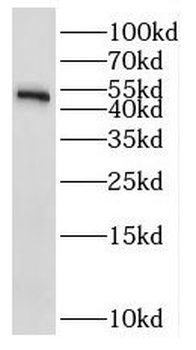NSFL1C Rabbit Polyclonal Antibody
