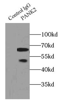 PANK2 antibody