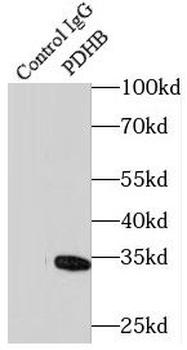 PDHB antibody