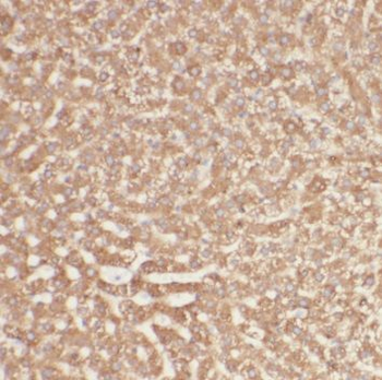 PNPO antibody